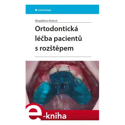 Ortodontická léčba pacientů s rozštěpem - Magdalena Koťová