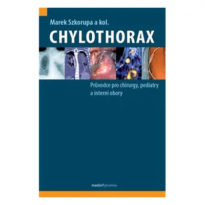 Chylothorax - Marek Szkorupa, kol.