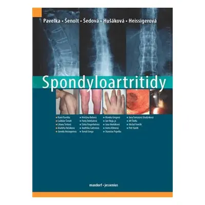 Spondyloartritidy - Karel Pavelka, kol., Ladislav Šenolt, Liliana Šedová, Markéta Hušáková, Jarm