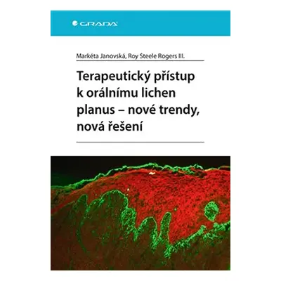 Terapeutický přístup k orálnímu lichen planus - Markéta Janovská, Roy Steele Rogers III.