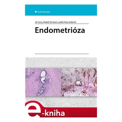 Endometrióza - Jiří Lenz, Radek Chvátal, Luděk Fiala