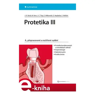 Protetika III - Jörg Rudolf Strub, Matthias Kern, Jens Christoph Türp, Siegbert Witkowski, Guido