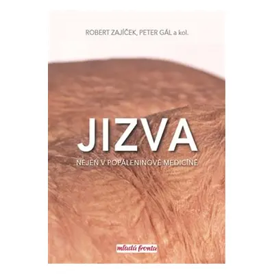 Jizva nejen v popáleninové medicíně - Robert Zajíček, kol., Peter Gál