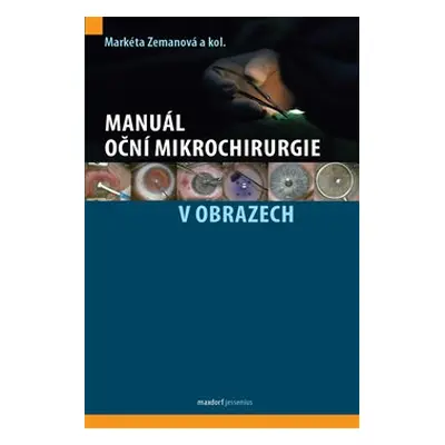 Manuál oční mikrochirurgie v obrazech - Markéta Zemanová, kol.