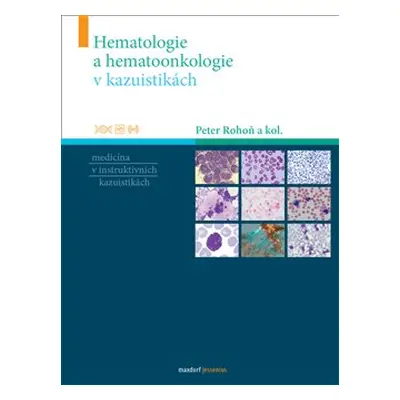 Hematologie a hemootonkologie v kazuistikách - Peter Rohoň, kol.