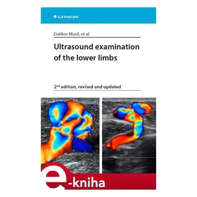 Ultrasound examination of the lower limbs - Dalibor Musil