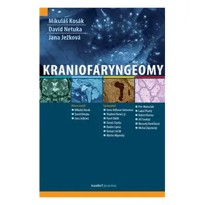 Kraniofaryngeomy - Mikuláš Kosák, David Netuka, Jana Ježková, kol.