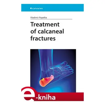 Treatment of calcaneal fractures - Vladimír Popelka