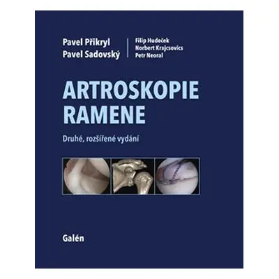 Artroskopie ramene - Pavel Sadovský, Pavel Přikryl, Filip Hudeček, Norbert Krajcsovics, Petr Neo