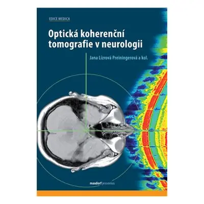 Optická koherenční tomografie v neurologii - Jana Preiningerová Lízrová, kol.