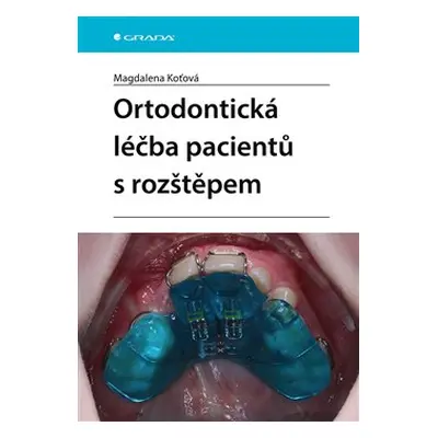 Ortodontická léčba pacientů s rozštěpem - Magdalena Koťová