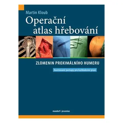 Operační atlas hřebování zlomenin proximálního humeru - Martin Kloub