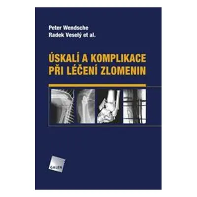 Úskalí a komplikace při léčení zlomenin - kol., Radek Veselý, Peter Wendsche