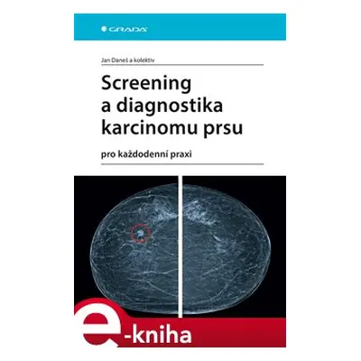 Screening a diagnostika karcinomu prsu - kolektiv, Jan Daneš