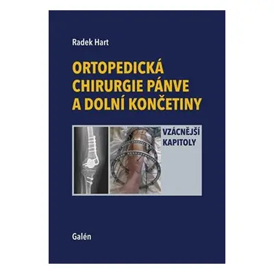 Ortopedická chirurgie pánve a dolních končetin - Radek Hart