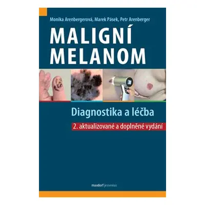 Maligní melanom – Diagnostika a léčba - Petr Arenberger, Monika Arenbergerová, Marek Pásek