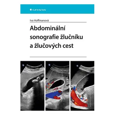 Abdominální sonografie žlučníku a žlučových cest - Iva Hoffmanová