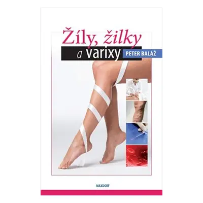 Žíly, žilky a varixy - Peter Baláž