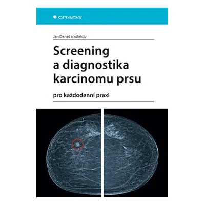 Screening a diagnostika karcinomu prsu - kolektiv, Jan Daneš