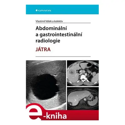 Abdominální a gastrointestinální radiologie - Játra - kolektiv, Vlastimil Válek