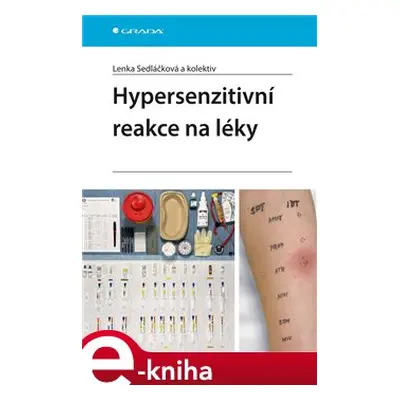 Hypersenzitivní reakce na léky - Lenka Sedláčková, kolektiv