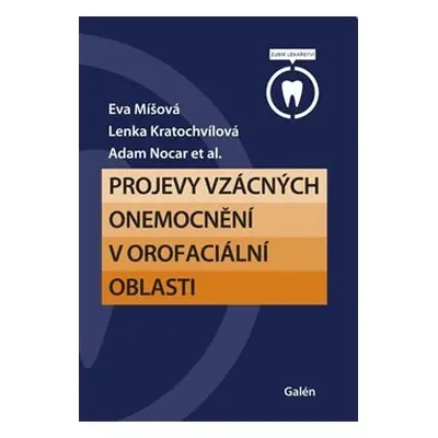 Projevy vzácných onemocnění v orofaciální oblasti - Eva Míšová, Lenka Kratochvílová, Adam Nocar