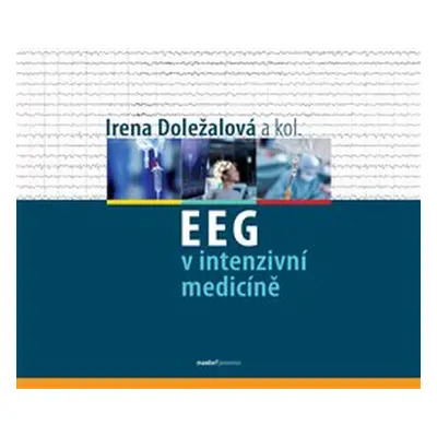 EEG v intenzivní medicíně - Irena Doležalová, kol.