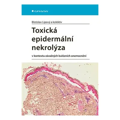 Toxická epidermální nekrolýza - Břetislav Lipový, kol.