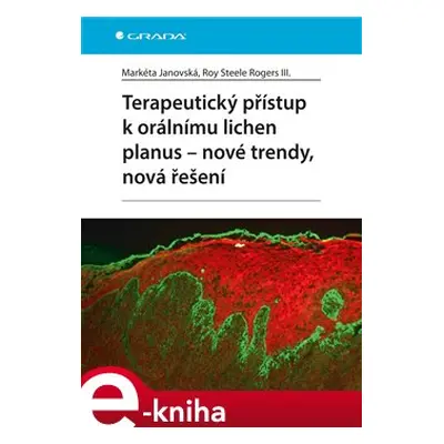 Terapeutický přístup k orálnímu lichen planus - Markéta Janovská, Roy Steele Rogers III.