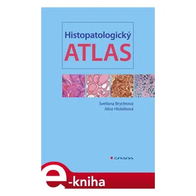 Histopatologický atlas - Svetlana Brychtová, Alice Hlobilková