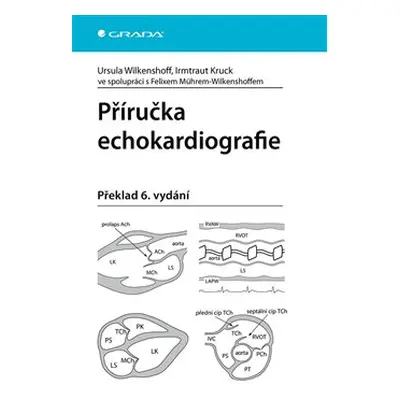 Příručka echokardiografie - Irmtraut Kruck, Ursula Wilkenshoff