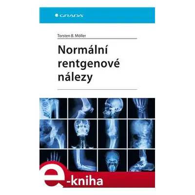 Normální rentgenové nálezy - Torsten B. Möller