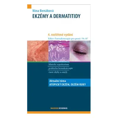 Ekzémy a dermatitidy - Nina Benáková