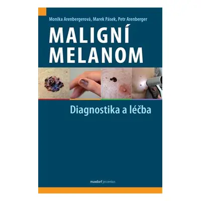 Maligní melanom – Diagnostika a léčba - Petr Arenberger, Monika Arenbergerová, Marek Pásek