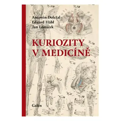 Kuriozity v medicíně - Antonín Doležal, Eduard Hábl, Jan Lomíček