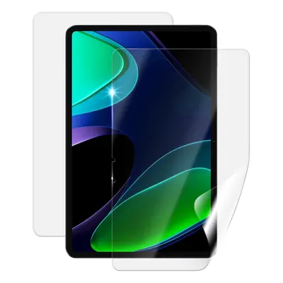 Ochranná fólie Screenshield pro Xiaomi Pad 6, celé tělo