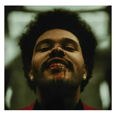 The Weeknd - After Hours (2 LP)