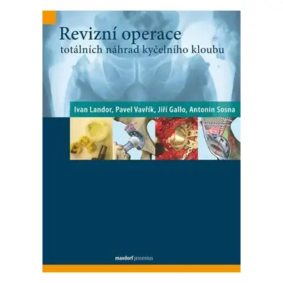 Revizní operace totálních náhrad kyčelního kloubu