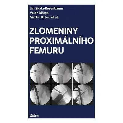 Zlomeniny proximálního femuru