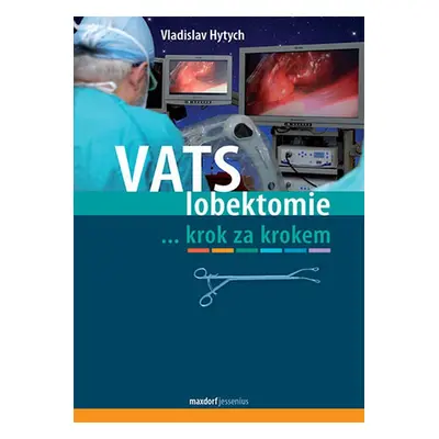 VATS lobektomie