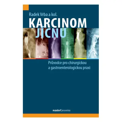 Karcinom jícnu