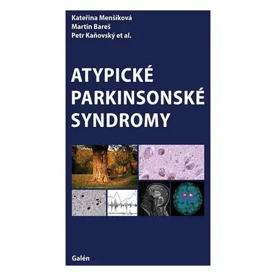 Atypické parkinsonské syndromy