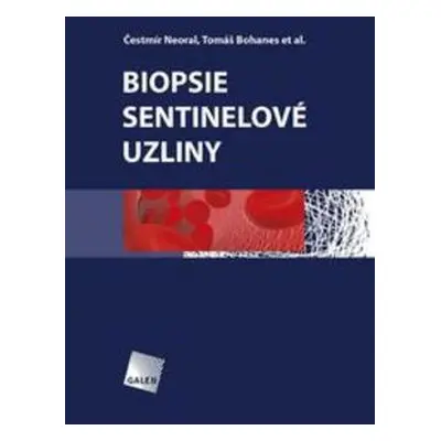 Biopsie sentinelové uzliny