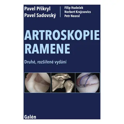 Artroskopie ramene