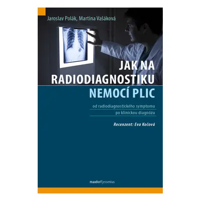 Jak na radiodiagnostiku nemocí plic