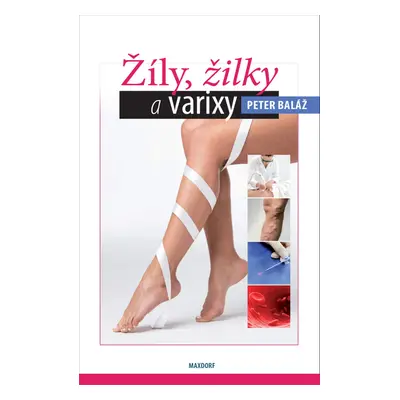 Žíly, žilky, varixy