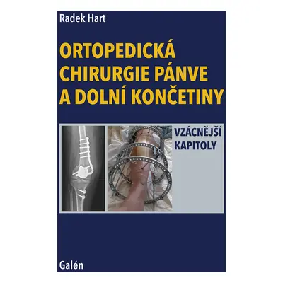 Ortopedická chirurgie pánve a dolní končetiny