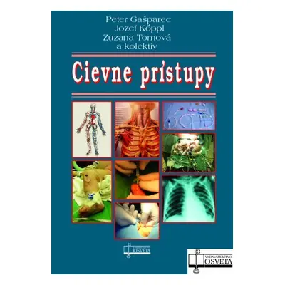 Cievne prístupy