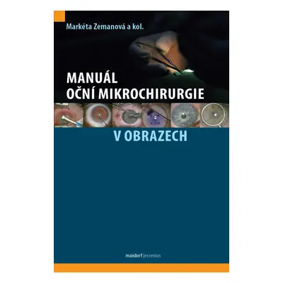 Manuál oční mikrochirurgie v obrazech