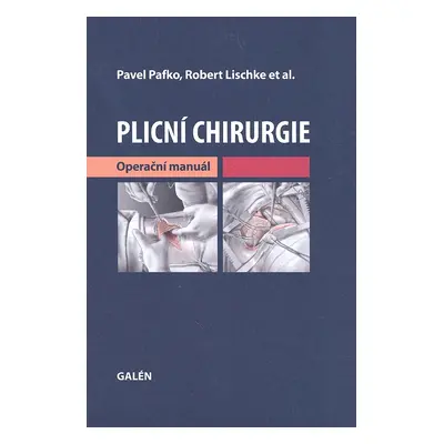 Plicní chirurgie